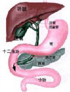 慢性膽囊炎和膽石症