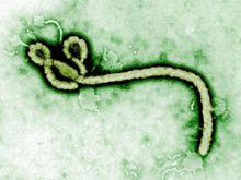 自然界的完美殺手——伊波拉病毒