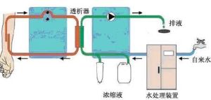 血液透析