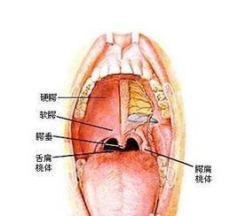 過敏性咽炎症狀