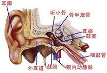 骨瘍型中耳炎