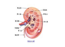 安卡性腎炎