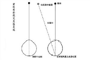 麻痹性斜視