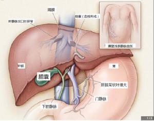 布-加綜合徵