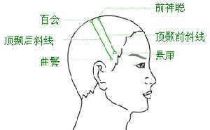 頂顳後斜線