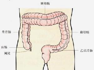假膜性小腸結腸炎