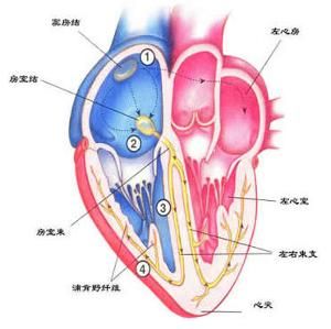 心臟神經官能症