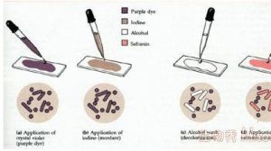 革蘭氏結晶紫染色試劑盒