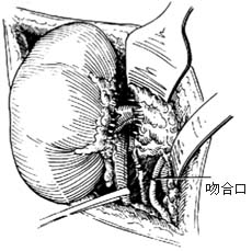 淋巴管