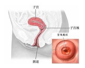 宮頸柱狀上皮異位