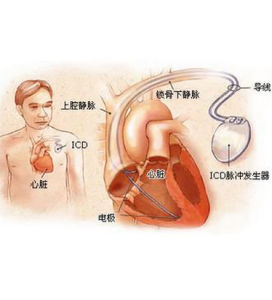 竇性心律失常