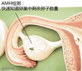 AMH[抗繆勒管激素英文簡稱]