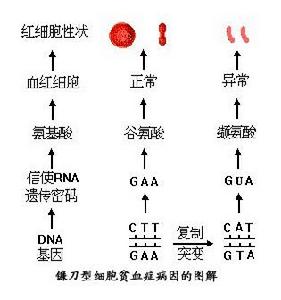 貧血症