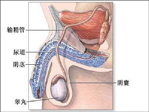 輸精管梗阻