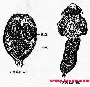 肝多房棘球絛蟲感染