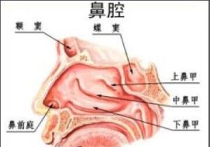 肥厚性鼻炎