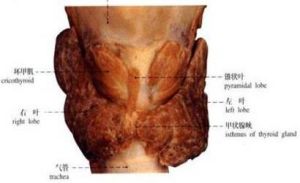 假性甲狀旁腺功能減退症