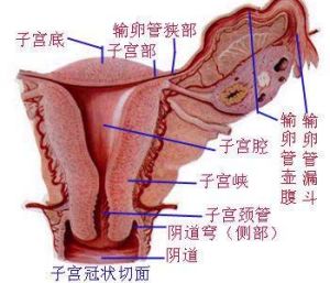 子宮畸形