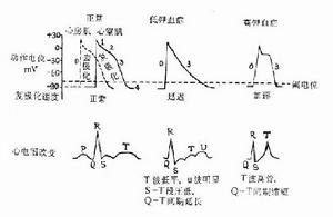 慢性特發性低鉀血症