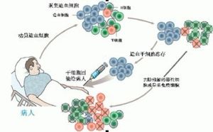 原基因幹細胞造血療法