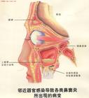 職業性喉病