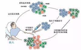 幹細胞移植治療