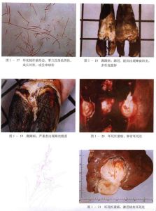 豬壞死桿菌病