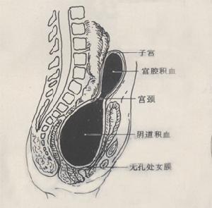 繼發性閉經