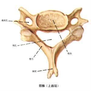 髖關節脫位