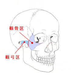 顴骨整形