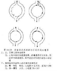 心電機械分離