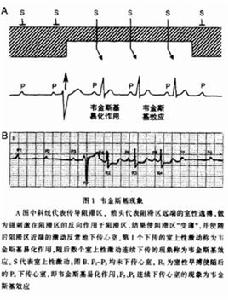 維金斯基現象