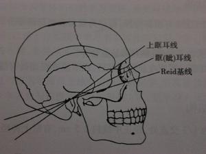 眶耳線